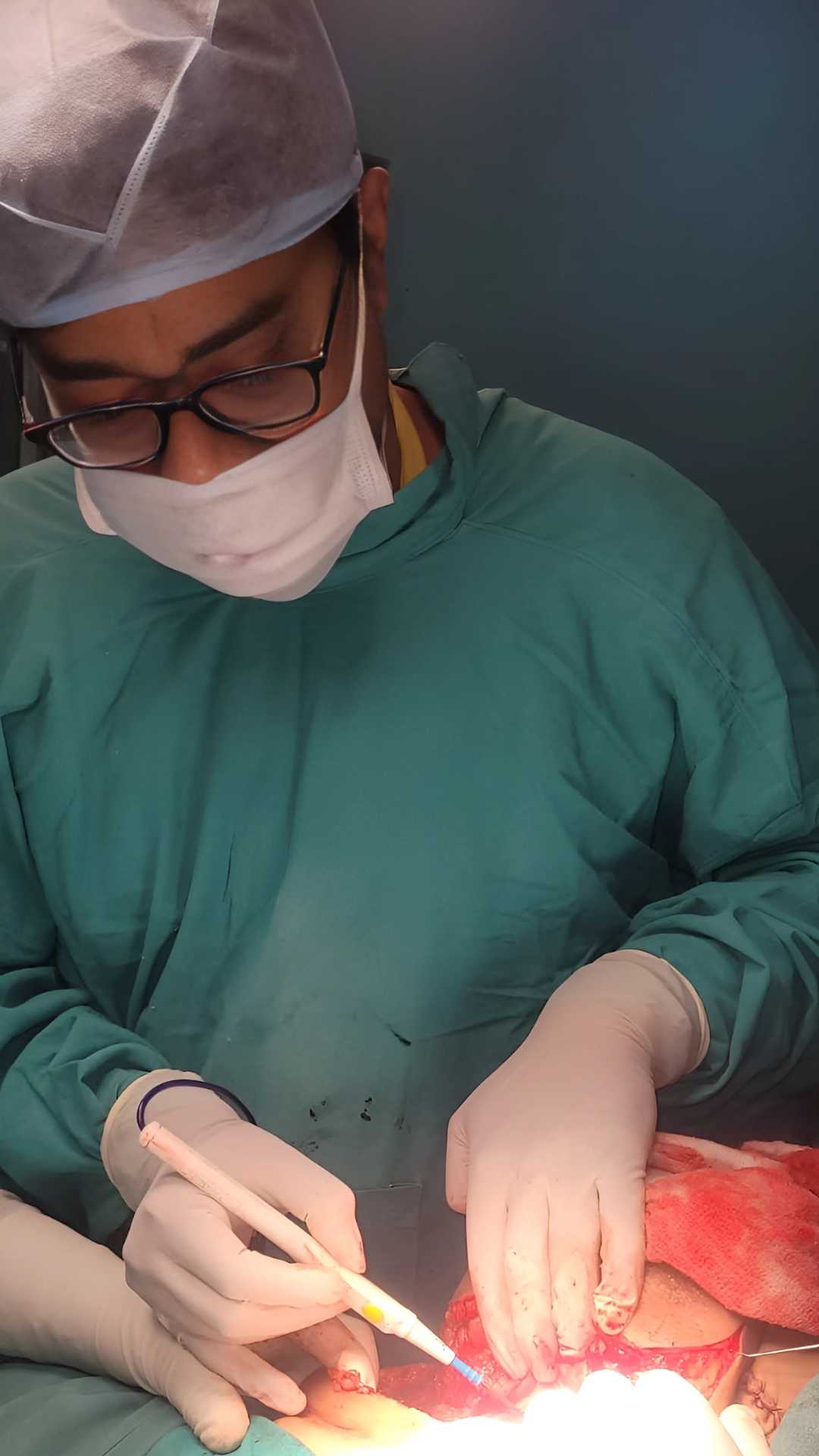 Dr Sarvesh Gupta Cancer Surgery